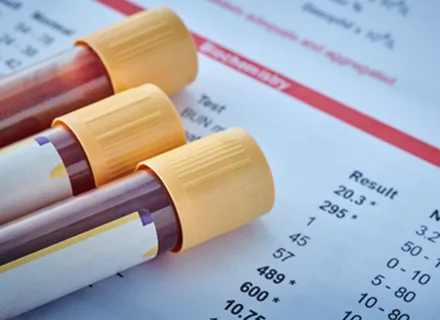Blood Tests at Kidz Care Children's Hospital